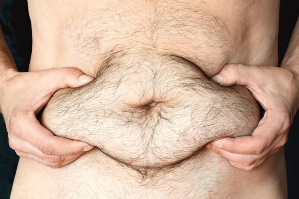 istock A man shows his fat belly 1335264743
