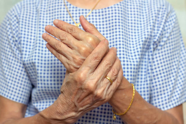 handhalten erwachsene frau mit schmerzen in muskeln und gelenken,symptome einer peripheren neuropathie und taubheitsgefühl in fingerspitze und handfläche,krankheiten, die durch nebenwirkungen der impfung verursacht werden,guillain-barre-syndrom (gbs) - rheumatism human finger human hand human arm stock-fotos und bilder