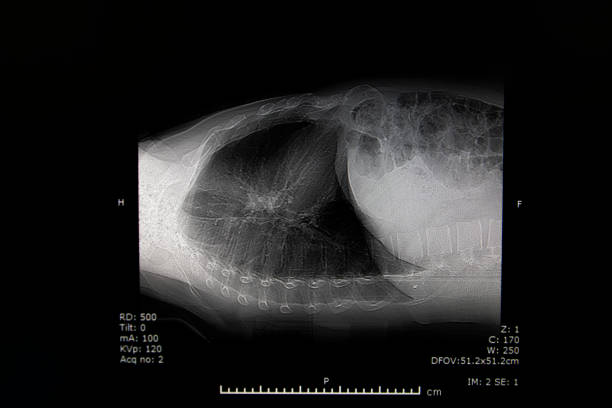 Computed tomography of chest organs. CT scan. CT Abdomen Cross section View.