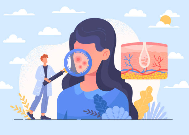 ilustraciones, imágenes clip art, dibujos animados e iconos de stock de cuidado de la salud de la piel y dermatología y concepto abstracto - dermatología