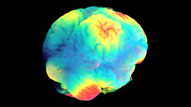 istock 3D visualization of the digital study of the human brain, using MTR and tomography. As a result of this study, complete information was obtained about changes in the patient's brain during the clinical stage and after six months in remission. 1335424588