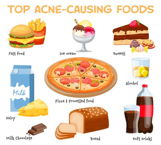 ilustrações, clipart, desenhos animados e ícones de o que causa acne. comida causadora de acne. ilustração vetorial - lubrication infection