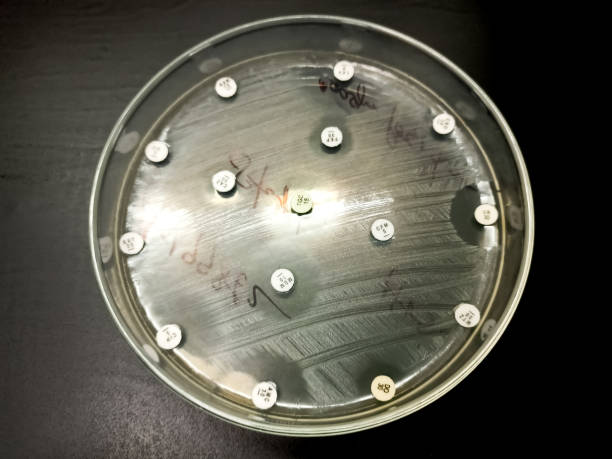 대장균 균에 대한 항생제 감도 테스트. - bacterium staphylococcus colony epidemic 뉴스 사진 이미지