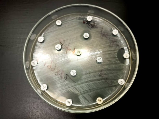 testes de sensibilidade a antibióticos contra bactérias e. coli. - bacterium staphylococcus colony epidemic - fotografias e filmes do acervo