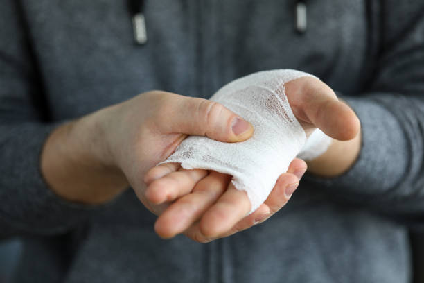 un homme montre un bras blessé rembobiné avec un bandage blanc - gauze photos et images de collection