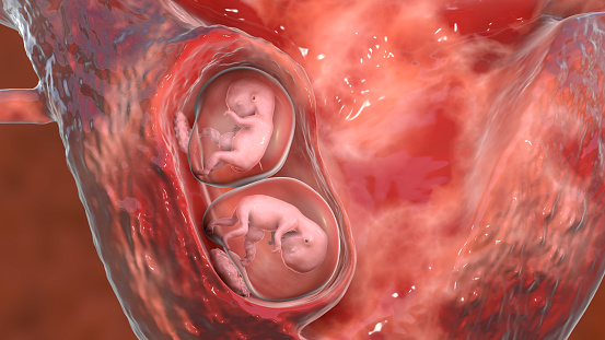 Monozygotic twins in uterus with one chorion and two amnions, 3D illustration. Human embryos at the age of 8 weeks