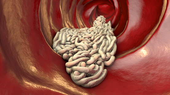 Parasitic worms in the lumen of intestine, 3D illustration. Growth and multiplication of nematode worms invading human intestine