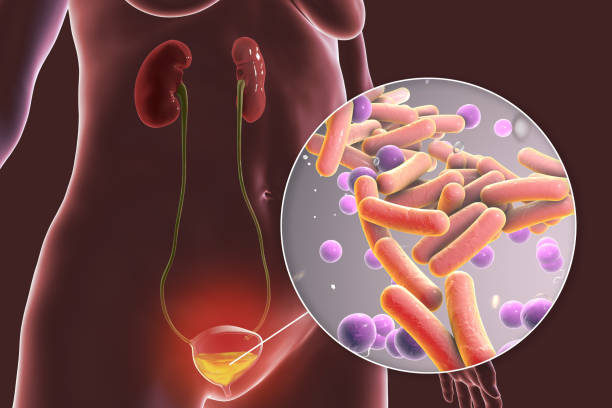 cystitis, bacterial infection of urinary bladder, conceptual 3d illustration - klamydiatest bildbanksfoton och bilder