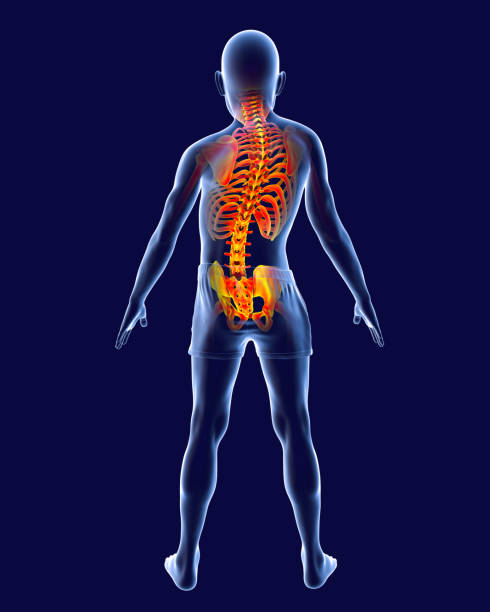 척추측만증, 3d 일러스트레이션. 척추 곡선 해부학 - human spine chiropractor three dimensional shape healthcare and medicine 뉴스 사진 이미지