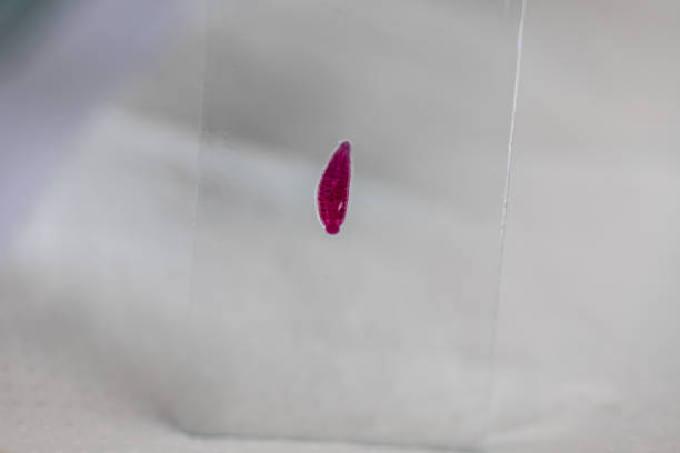 istock The study parasite or worms is a freshwater fish parasite in laboratory. 1336129602