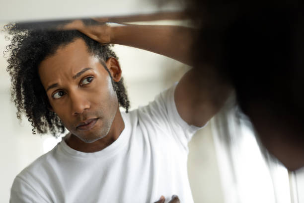 hombre preocupado por la alopecia que comprueba la pérdida del cabello - mano en el cabello fotografías e imágenes de stock