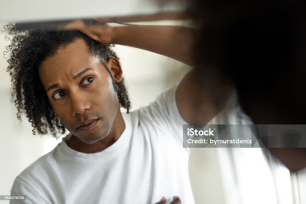 Man worried for alopecia checking hair for loss Men Stock Photo