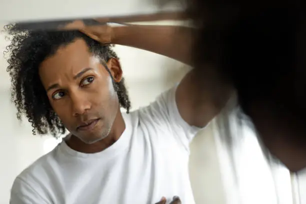 Photo of Man worried for alopecia checking hair for loss