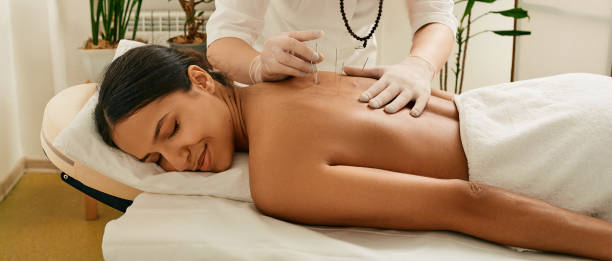 acupuntura para as costas de uma jovem em uma clínica chinesa. visão traseira - acupuncturist - fotografias e filmes do acervo