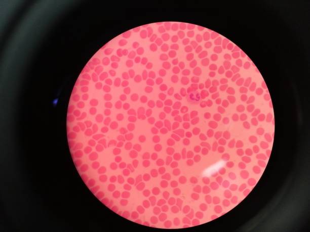 red blood cell sample - blood red blood cell blood cell blood sample imagens e fotografias de stock