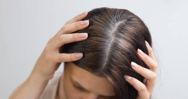 nahaufnahme sind fragmente von grauen haaren auf dem kopf einer jungen frau. frühes graues haarkonzept. graue haarfarbe und -struktur - graues haar stock-fotos und bilder