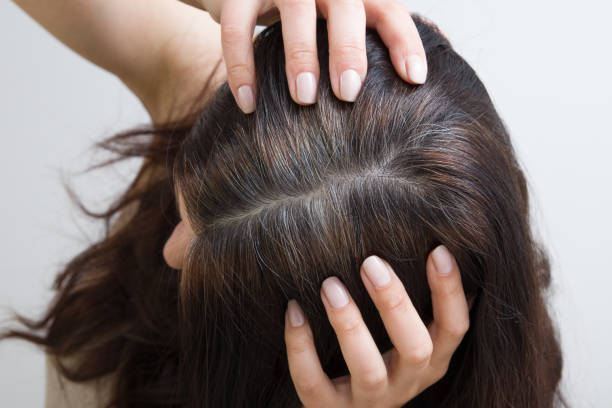 la donna mostra i capelli grigi sulla testa. capelli con frammenti di capelli grigi, radici di capelli che richiedono tintura - gray hair immagine foto e immagini stock