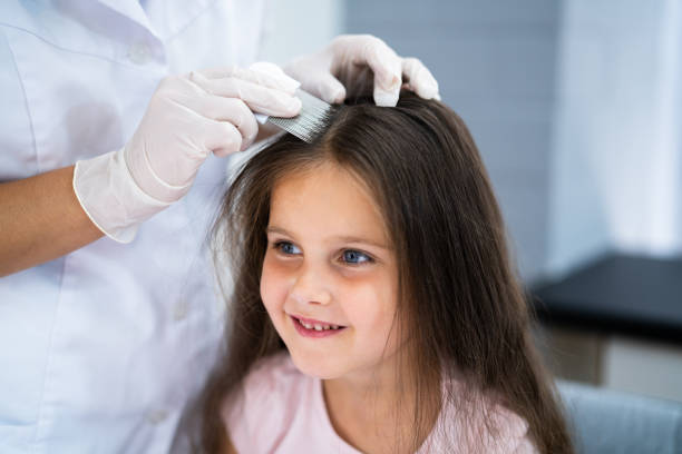 medico infantile che controlla i capelli della testa - loose hair foto e immagini stock