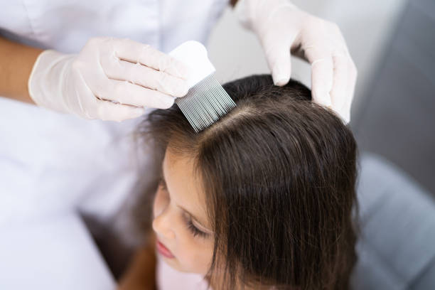 Child Doctor Checking Head Hair Child Doctor Checking Head Hair For Lice girl with lice stock pictures, royalty-free photos & images