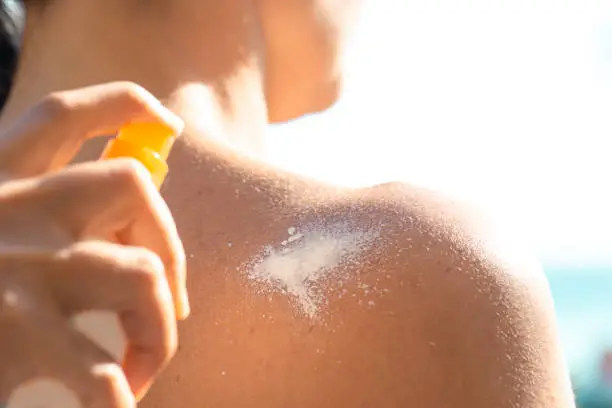 Woman hand applying suntan lotion to her friend’s shoulder.
