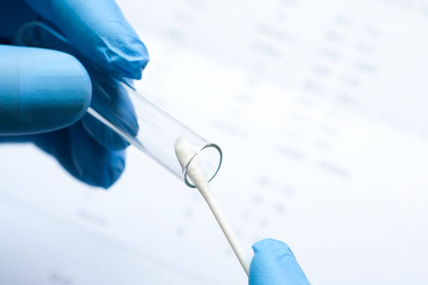 Doctor holds a COVID-19 swab collection, wears blue gloves and a PPE protective mask, and carries a test tube to collect the OP NP and  test coronavirus. Doctor holds a COVID-19 swab collection, wears blue gloves and a PPE protective mask, and carries a test tube to collect the OP NP and  test coronavirus. dna test stock pictures, royalty-free photos & images