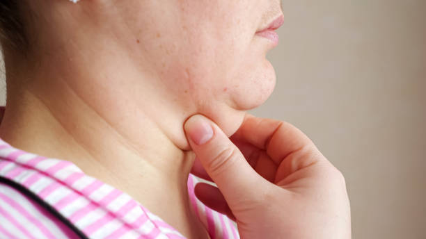 istock Unrecognizable woman touches double chin 1336700876