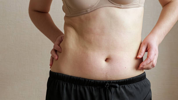 istock Unrecognizable woman feeling belly fat 1336700893