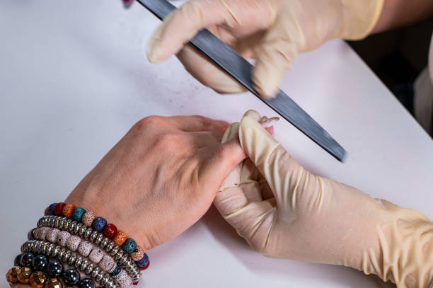 istock nail reconstruction with monophasic gel 1336701991