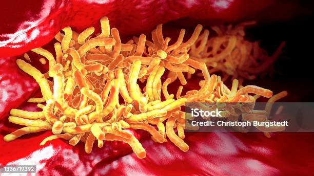 Accumulation Of Tuberculosis Bacteria Inside Pulmonary Tract 3d Illustration Stock Photo - Download Image Now