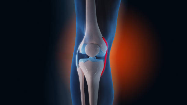 knee painful - human joint human knee pain x ray imagens e fotografias de stock