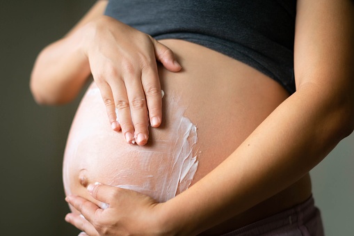 A pregnant mom applying lotion cream on her growing belly.