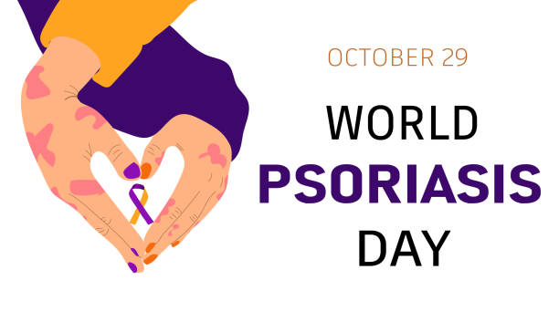 illustrations, cliparts, dessins animés et icônes de journée mondiale du psoriasis le 29 octobre. - psoriasis