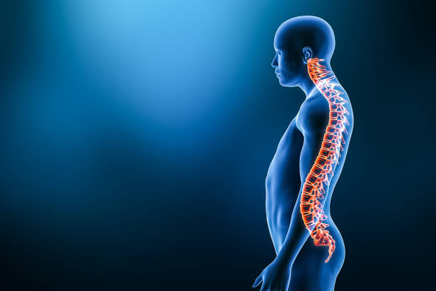 istock Lordosis pathology with man model from lateral view 3D rendering illustration with copy space. Human anatomy, spinal disorders or deformity, curvature of the spine, backbone pathology, medical concepts. 1337098706