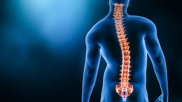 Curvature of the spine and man body back view 3D rendering illustration with copy space. Spine disorder or deformity, scoliosis, backbone injury, human anatomy and medical concepts. stock photo