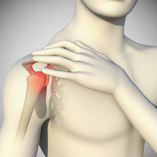 istock 3d Illustration of Shoulder Pain 1337114009