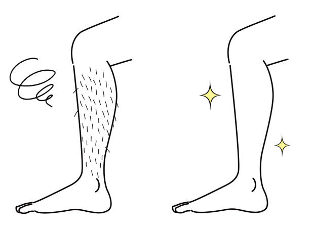 Hairy leg and beautiful depilated arm. Before and after Hairy leg and beautiful depilated leg. Before and after body hair stock illustrations
