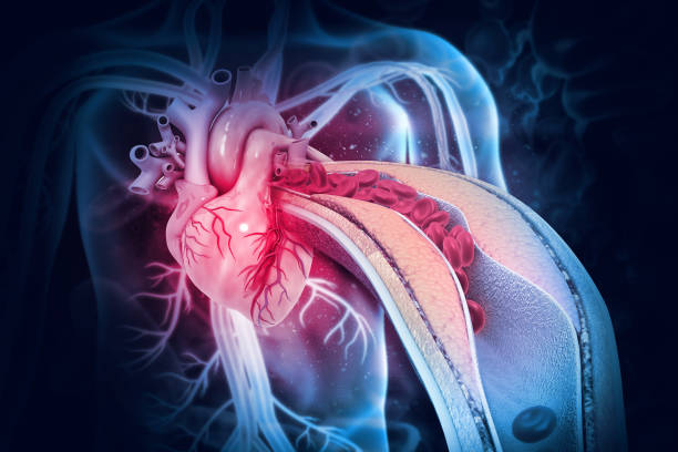 인간의 심장 해부학과 동맥에 콜레스테롤 플라크. 3d 일러스트레이션 - human artery 이미지 뉴스 사진 이미지