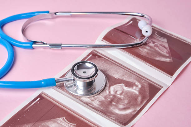 분홍색 배경에 의료 청진기 및 배아 사진 - obstetrician 뉴스 사진 이미지