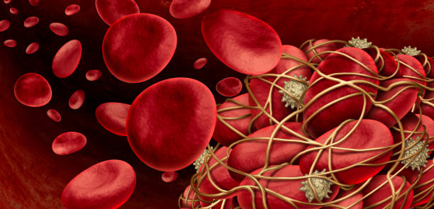 Blood Clot Inside Artery Blood clot and thrombosis medical illustration concept as a group of human blood cells clumped together by sticky platelets and fibrin creating a blockage in an artery or vein as a health disorder as a 3D illustration. blood clot photos stock pictures, royalty-free photos & images