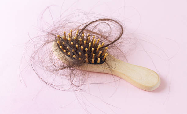 istock Comb brush with loss hair hairloss problem concept 1337463689