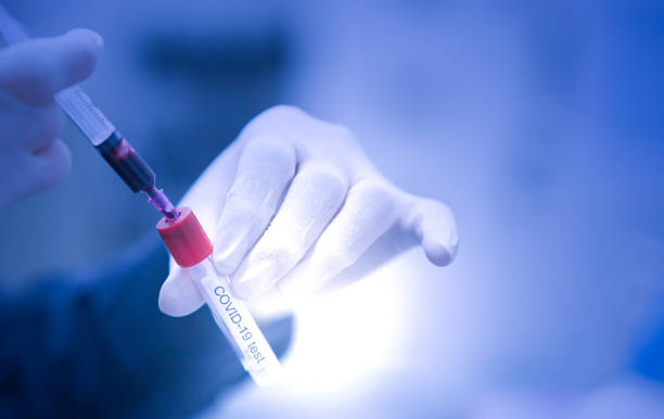 istock hand glove draw blood sample inside for test 1337593838