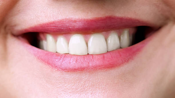 istock Close up of an unrecognizable woman's smile 1337608491