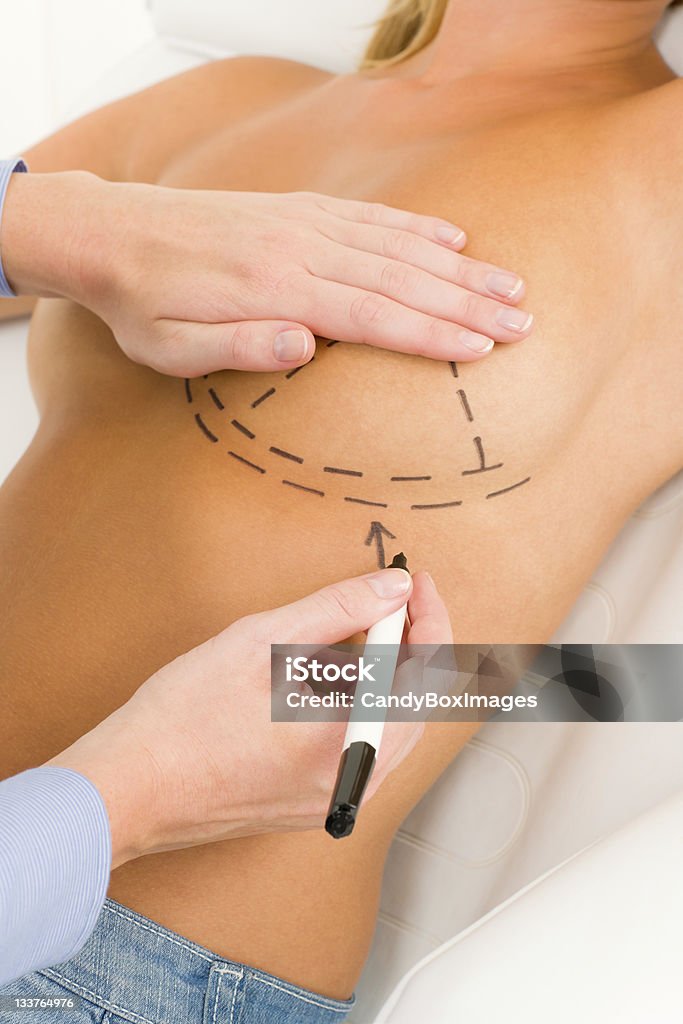 Medico chirurgia plastica disegnare seno paziente linea - Foto stock royalty-free di Adulto