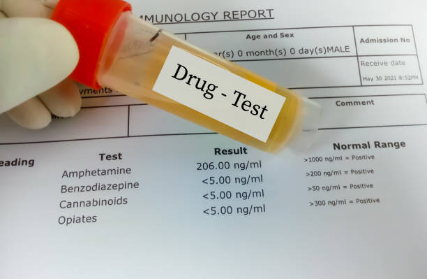 Drug test by urine stock photo