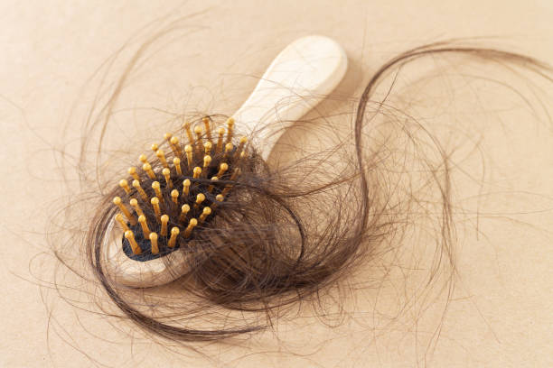 istock Brush with loss hair hairloss problem concept 1337869824