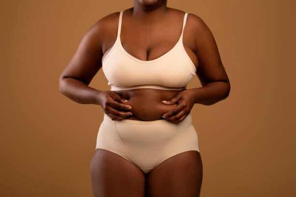 donna afroamericana curvy in biancheria intima che tiene pieghe grasse - liposuction foto e immagini stock