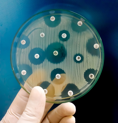 Antimicrobial susceptibility testing in petri dish. Antibiotic sensitivity of bacteria