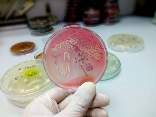 istock Colonies of bacteria in MacConkey agar (culture medium plate). petri dish 1337915372