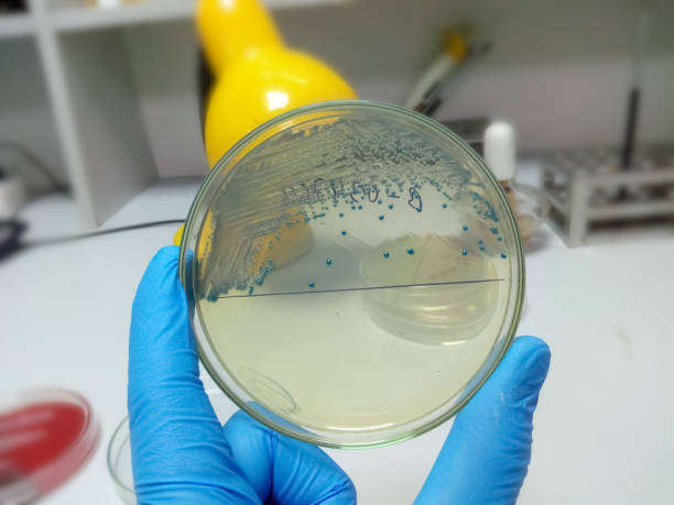 istock Bacterial colonies culture on selective agar media, agar plate, Close up. Enterobacteriaceae. 1337915627