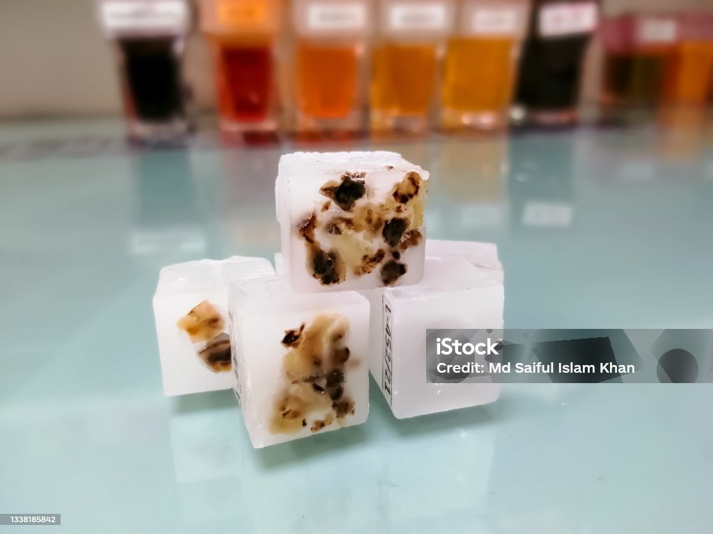 Paraffin embedded tissue blocks of cancer on isolated with laboratory Background.Medical patholology and cytology laboratory technology concept Analyzing Stock Photo
